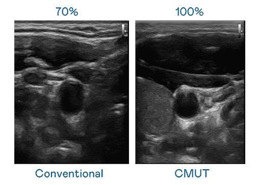 大频宽带来超清晰影像